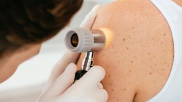 Melanoma insights could hold benefit for all cancers