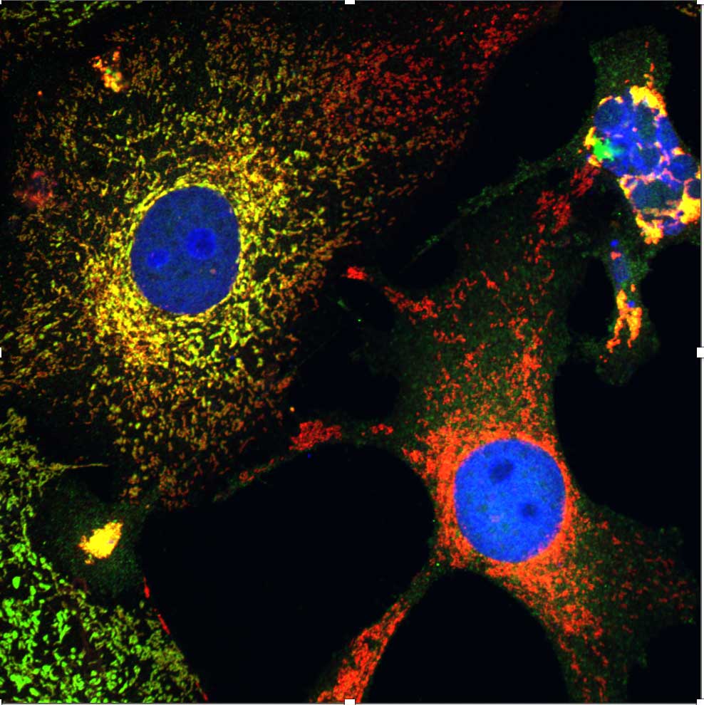 Curbing the cell stress response