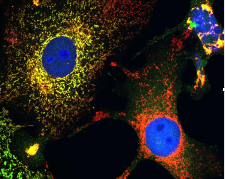 Curbing the cell stress response