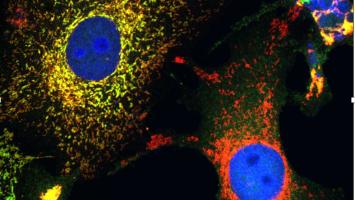 Curbing the cell stress response